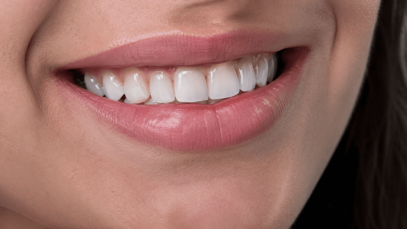 Alinhamento do sorriso